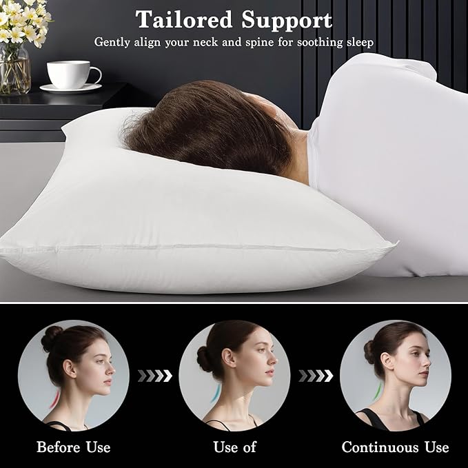 Shilucheng Goose Down Pillow Standard Size Set of 2 Pack,750+ Fill Power Luxury Hotel Quality Bed Feather Pillow for Side Back Stomach Sleepers, Soft 100% Cotton Shell（White,20" x 26"）